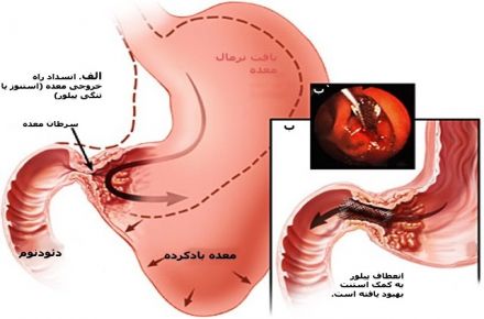 دکتر مژگان افشاری متخصص و فوق تخصص غدد - 1