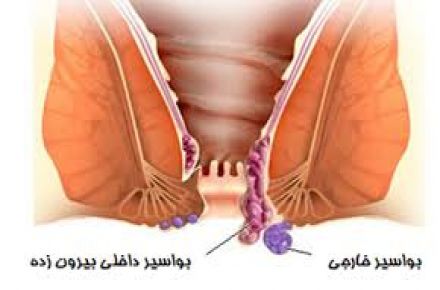 دکتر علی قزوینی فوق تخصص ریه - 1