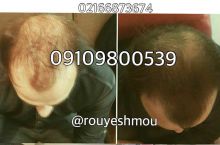 معجزه سرکه سیب برای مو