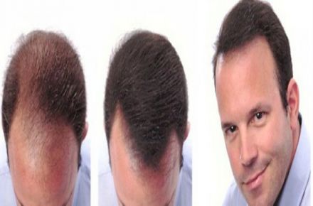 درمانگاه تخصصی پوست و موی ایران مهر - 1