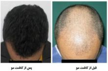 دکتر اعظم کریمی