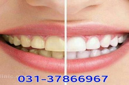 دندانپزشکی وحید اصفهان - 1
