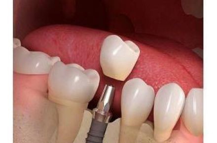 دندانپزشکی و زیبایی - 1