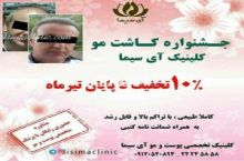  جشنواره کاشت مو کلینیک تخصصی آی سیما 