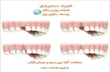 کلینیک دندانپزشکی دکتـــــرشمــــشــــیر - 1