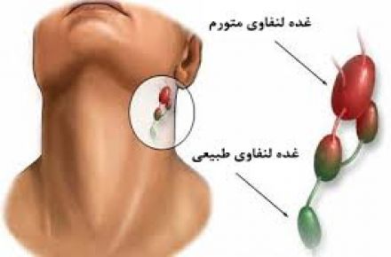 فوق تخصص غدد، رشد و متابولیسم کودکان .دکتر محمدرضا علایی - 1