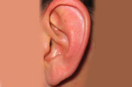 دکتر شروین سپنج جراح و متخصص گوش و حلق و بینی(جراحی زیبایی بینی) - 1
