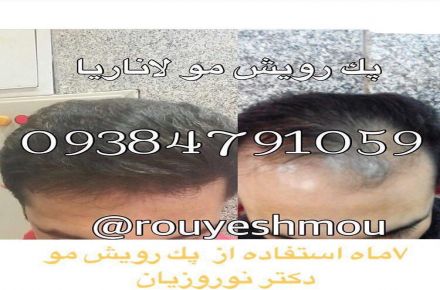 پکیج رشد مو دکتر نوروزیان عوارضی دارد؟ - 1