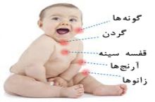 دکتر امیر حسین محبوبی فوق تخصص کلیه کودکان