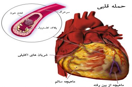 دکتر فرشته آرین فر فوق تخصص قلب و عروق - 1